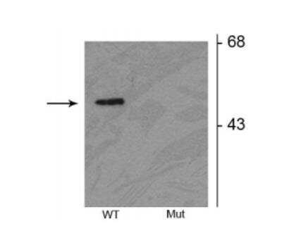 Western Blot: Parkin [p Ser378] Antibody [NB100-61107]